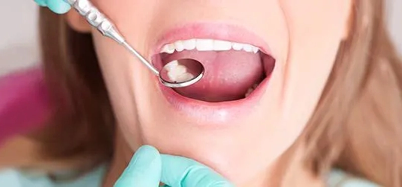 Cavity Treatment in Bilaspur
