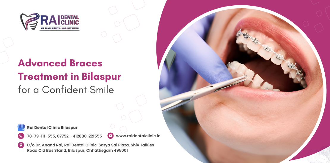 braces treatment in Bilaspur