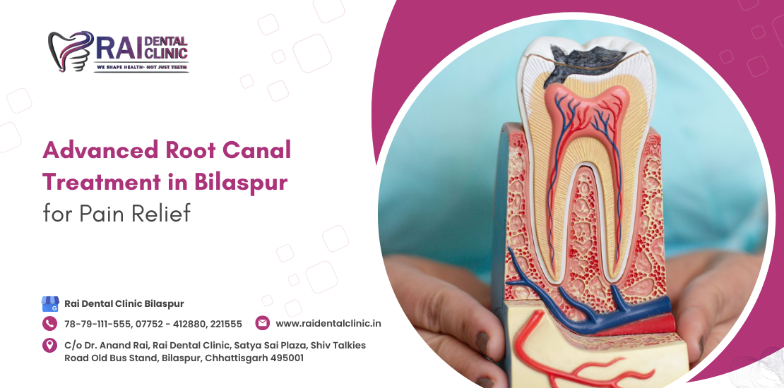 root canal treatment in Bilaspur