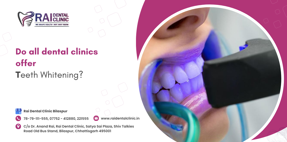 Do all dental clinics offer teeth whitening?