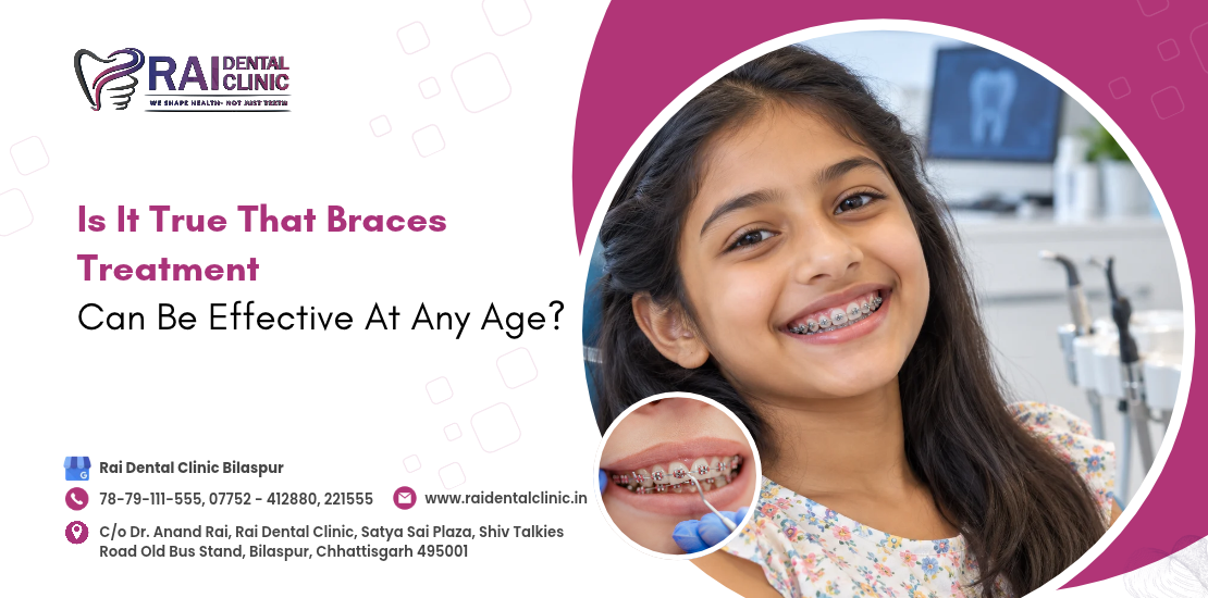Is It True That Braces Treatment Can Be Effective At Any Age ?
