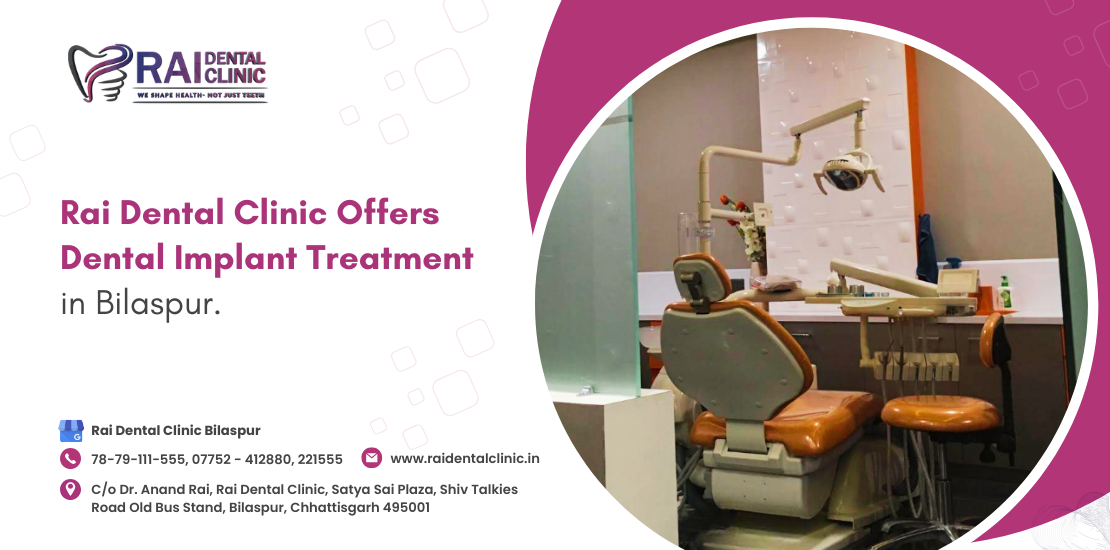 dental implant treatment in Bilaspur