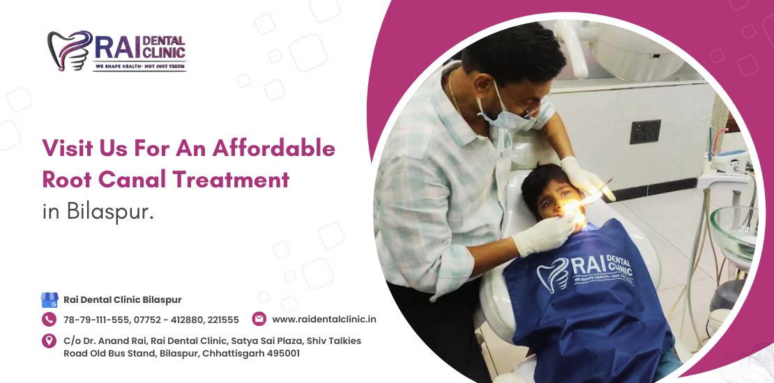 root canal treatment in Bilaspur