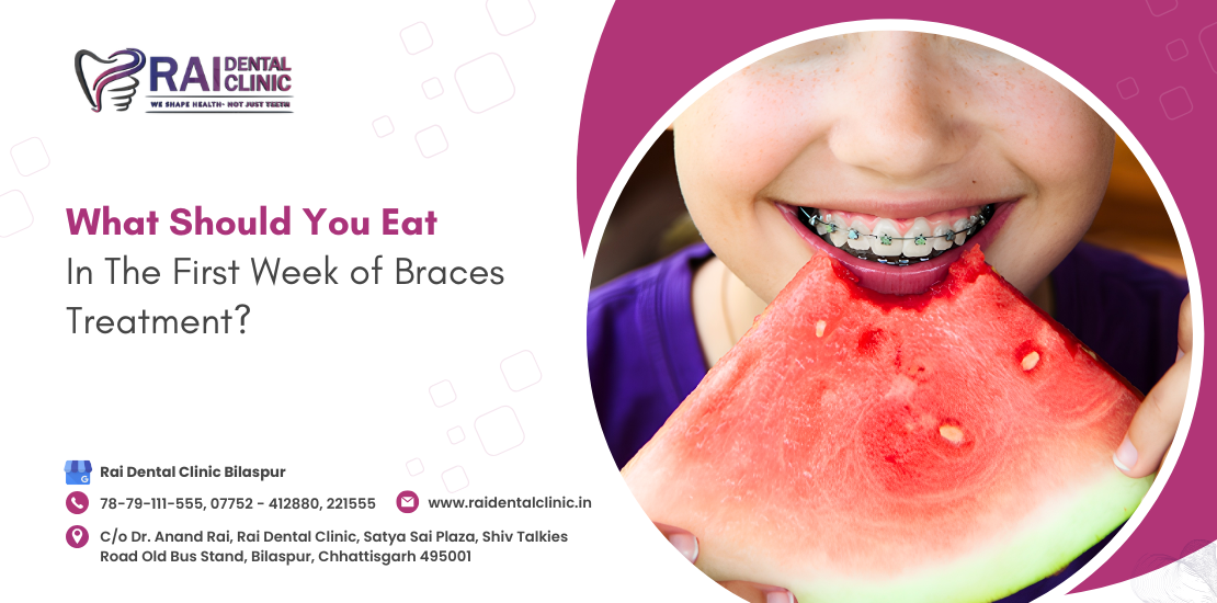 braces treatment
