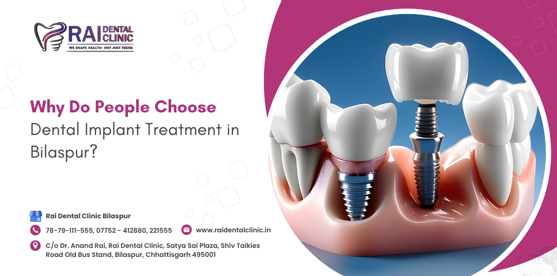 dental implant treatment in Bilaspur