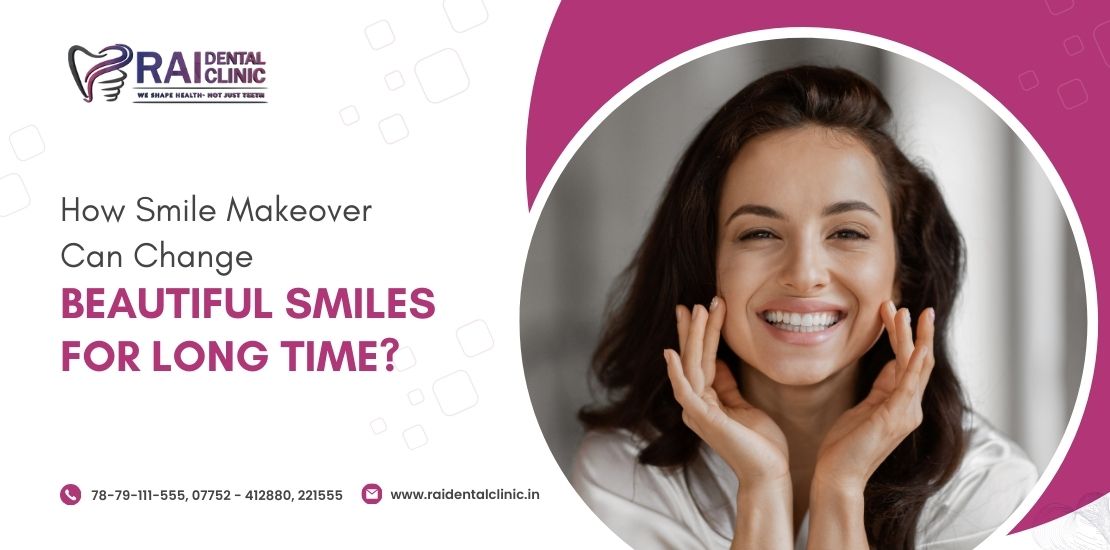 smile makeover in Bilaspur
