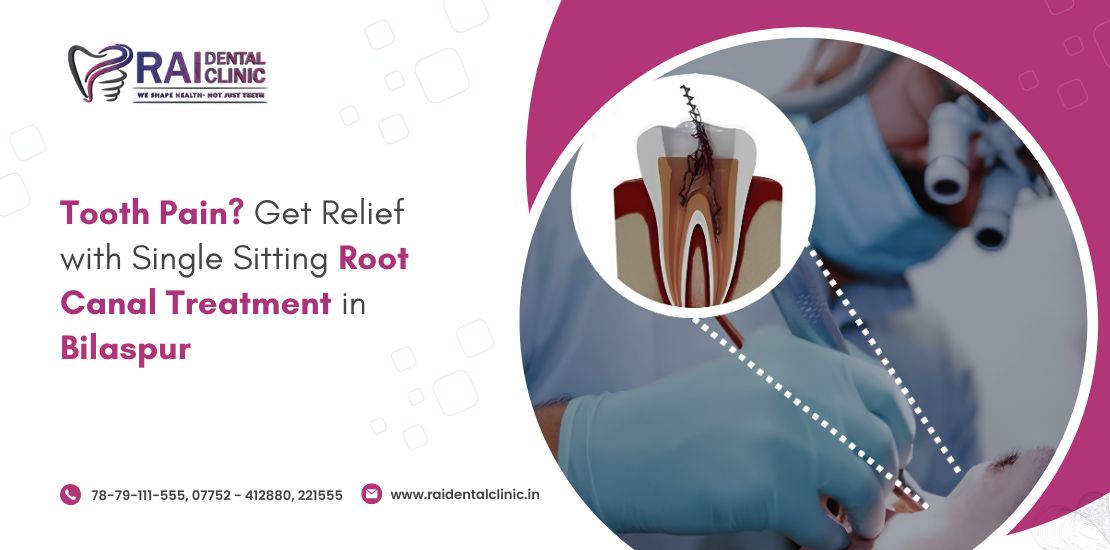 single sitting root canal treatment in bilaspur