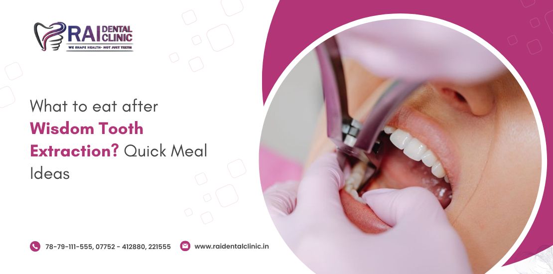 wisdom tooth extraction