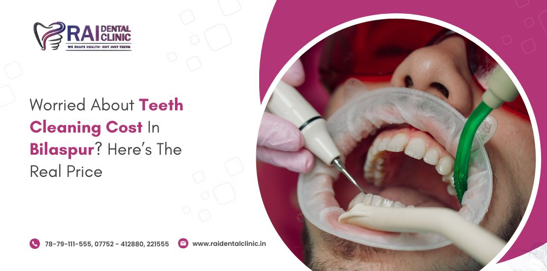 teeth cleaning cost in Bilaspur